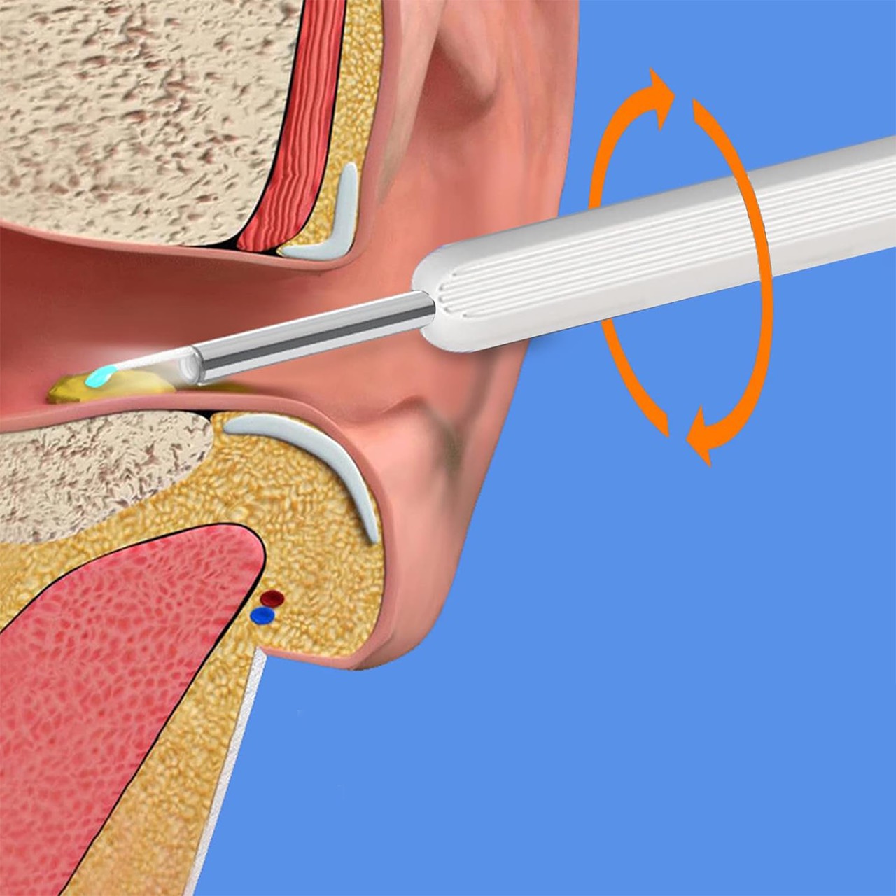 EarStick, a fülvaj tisztító segédeszköz kamerával - Image 2