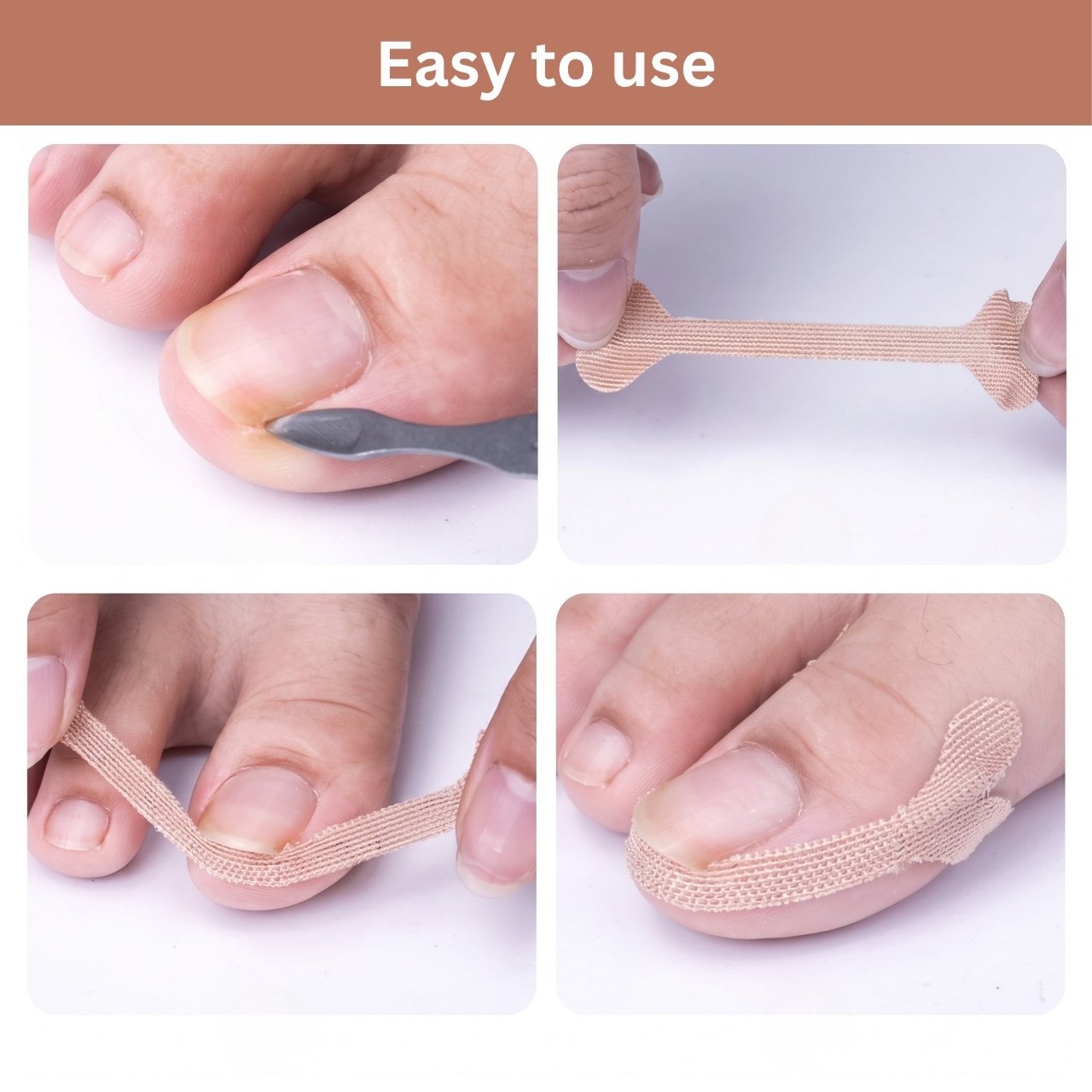 Benőtt köröm korrekciós tapaszok, ProPatches - Image 9